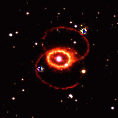 SN1987A